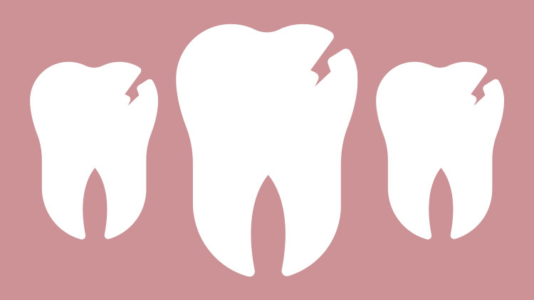 Managing dental damage